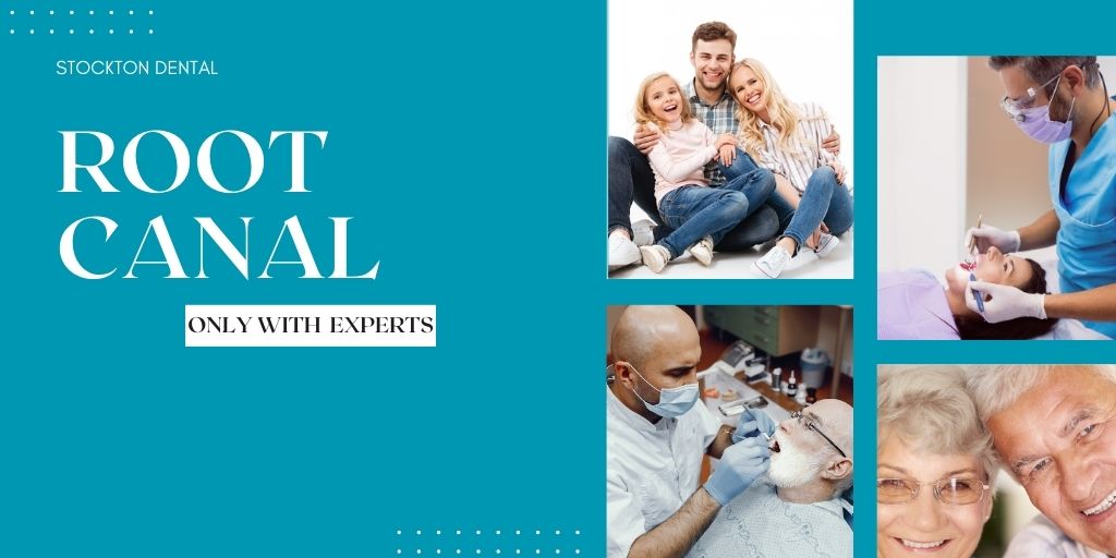 Root Canal Treatment at Stockton
